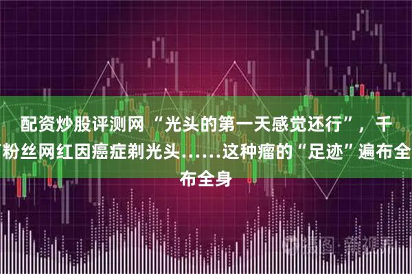 配资炒股评测网 “光头的第一天感觉还行”，千万粉丝网红因癌症剃光头……这种瘤的“足迹”遍布全身